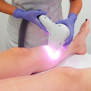 curso depilacion piernas laser diodo